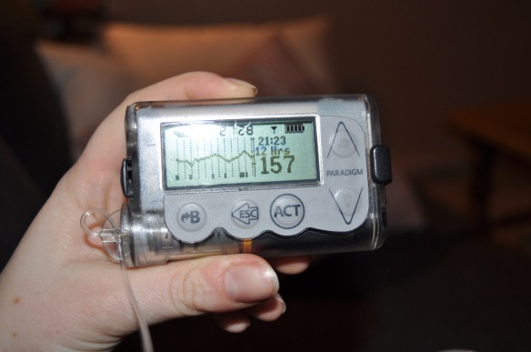 Diabète] J'ai testé le capteur de glucose en continu ! #17